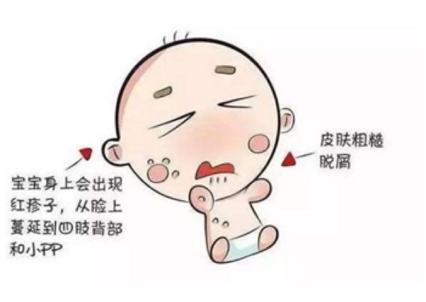 【家家母婴】"奶粉过敏"有什么症状?如何快速识别?