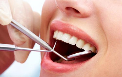 牙齿龋坏,楔状缺损或者牙齿不小心咬缺了一小块,都可以通过补牙修复