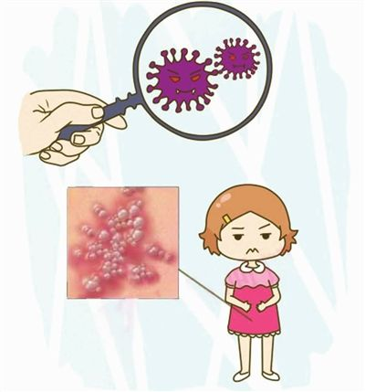 宝宝感染单纯疱疹不要慌,学会正确护理很重要!