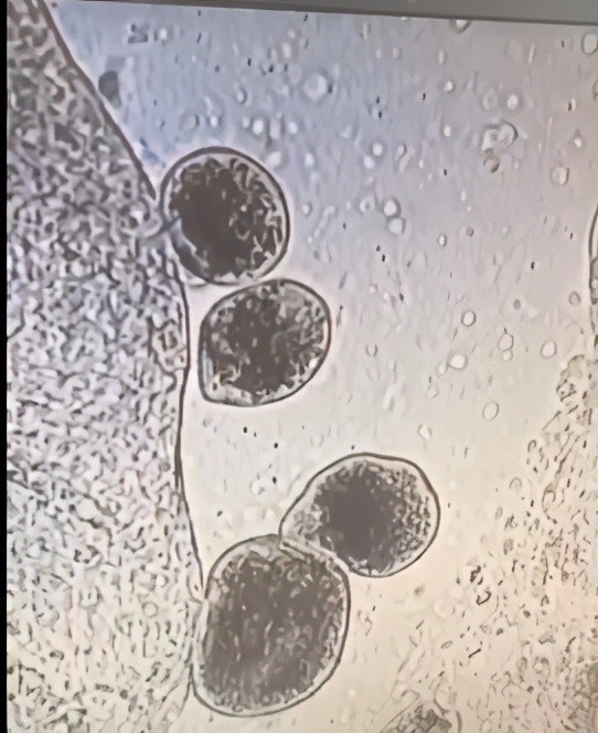 水产常见寄生虫小瓜虫,原来长这样|寄生虫|水产
