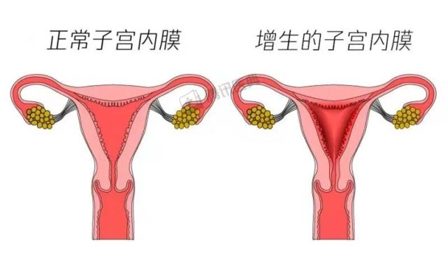 女人子宫里的这层膜薄了难怀孕厚了易致癌