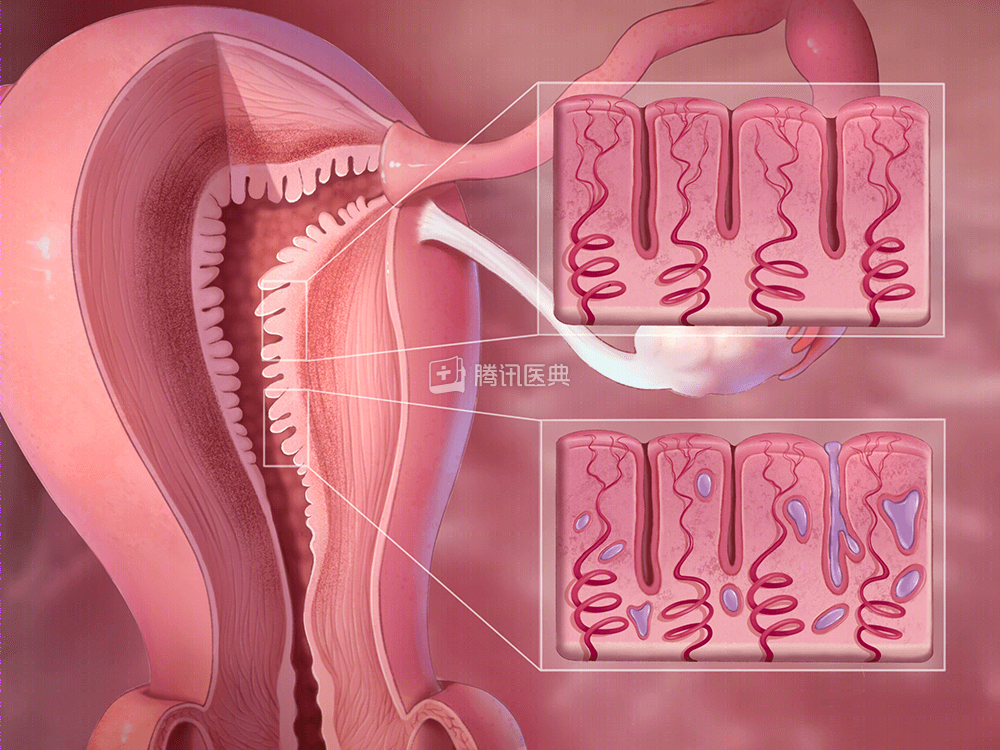 女人子宫里的这层膜,薄了难怀孕,厚了易致癌!