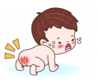 宝宝出现红臀怎么办