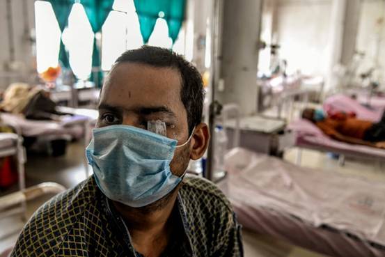 吓人!多种变异病株席卷印度,3万人中招,患者面部发霉痛不欲生