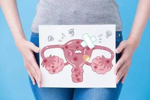 dsa可视动脉介入灌注治疗子宫内膜癌 深受患者好评!