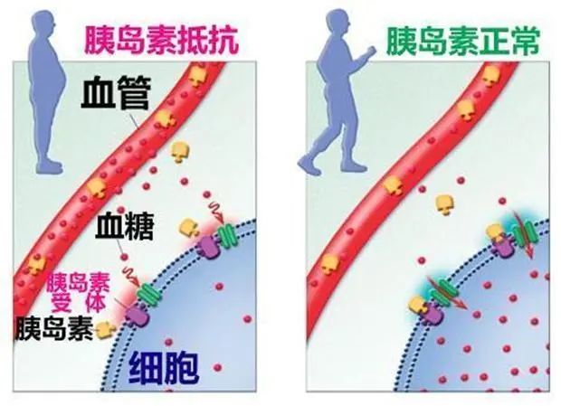 糖尿病患者血糖低症状_血糖低_低血糖的表现