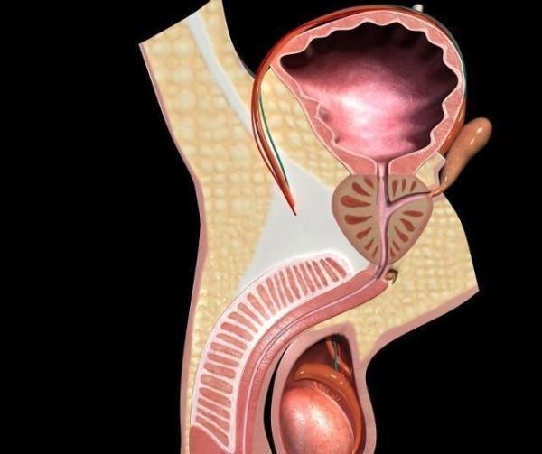 前列腺炎为何难以治愈?答案在这里,花一分钟了解一下_腾讯新闻