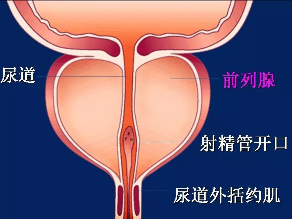 慢性前列腺炎一定由细菌引起吗?