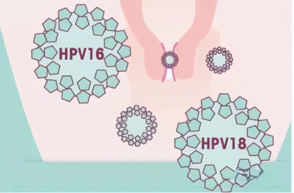 hpv和tct检查傻傻分不清楚?有何区别?女性该选择哪个呢?