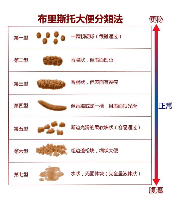 如果大便呈灰白色,特别是小婴儿黄疸期间,需尽快就诊排除胆道问题. 1.