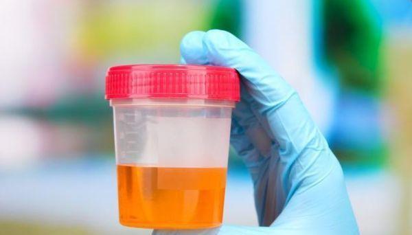 尿液泡沫多是肾病预兆?出现3种情况要警惕肾功能衰竭