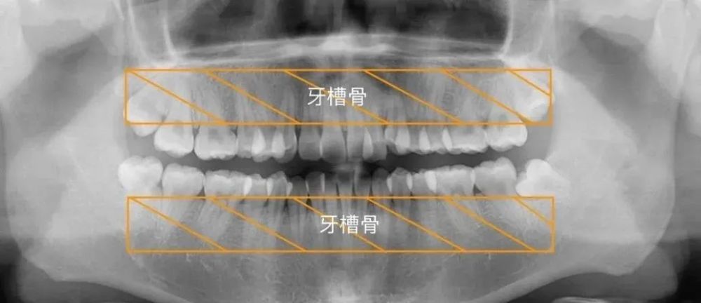 到底多少岁就不能矫正牙齿了?