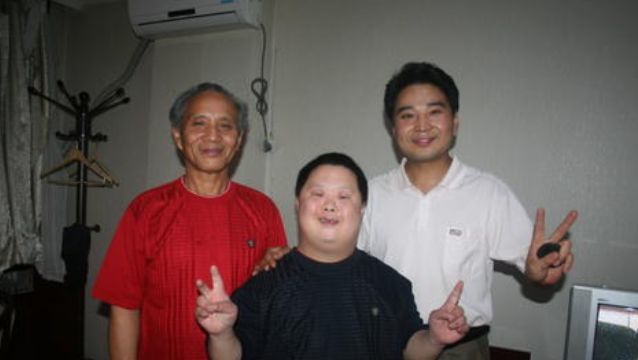 先天性愚型 腾讯网