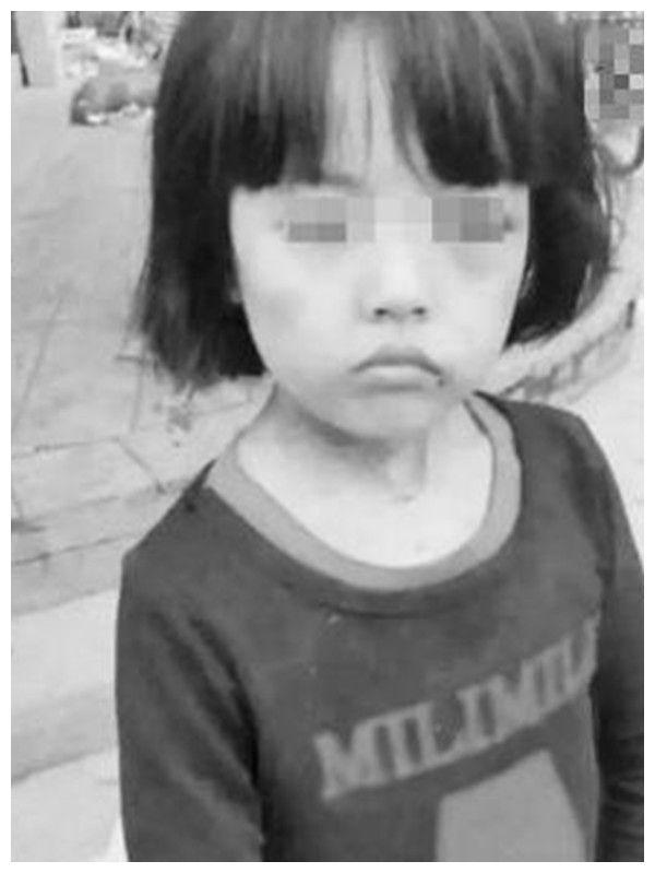 案件回顾:青海小苏丽,3岁被用针线缝嘴,5岁被虐死,生母却只判7年