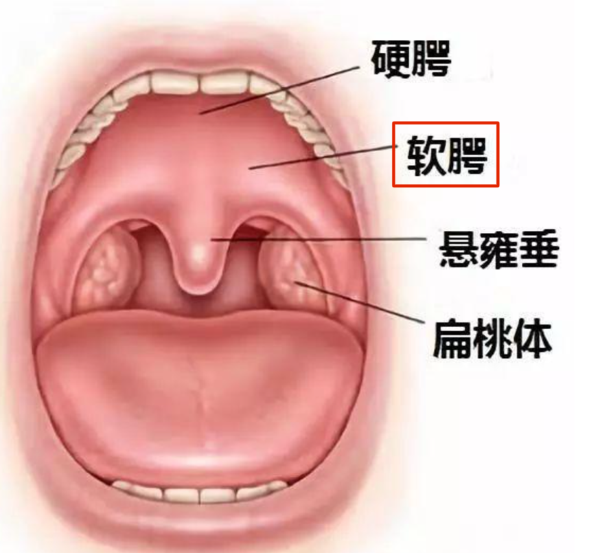 软腭功能锻炼法