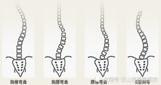 怎么有效的保护新生儿脊柱侧弯的问题,通常脊柱侧弯的位置都在什么