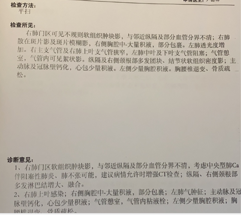 一例胸腔积液之低分化癌的捕漏心得