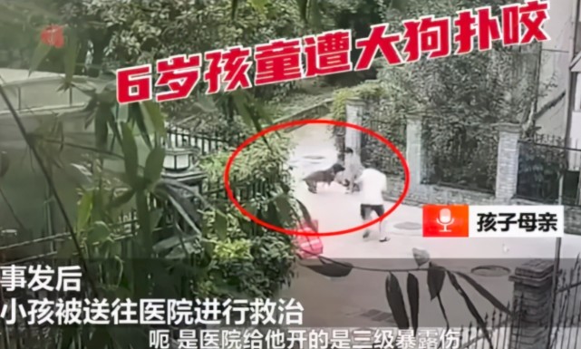 武汉一小区现恶狗伤人恶犬扑咬6岁孩子致皮开肉绽狗主人拒不承认声称
