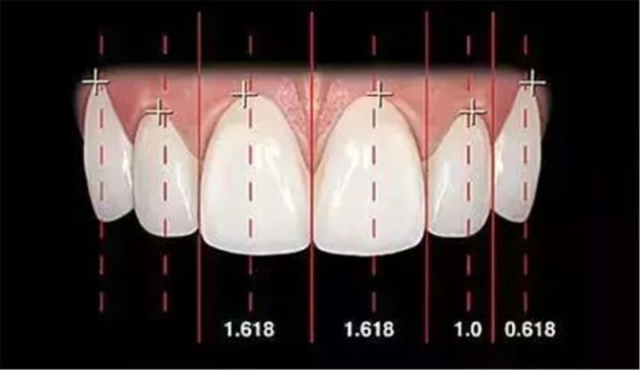 b,两上中切牙宽度约是高度的80%;两侧上中切牙完全对称;牙齿轴面与