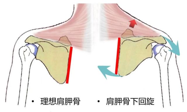 坡度自然下凹 但因为长期低头等原因 不少人的肩胛骨往下转(下回旋)