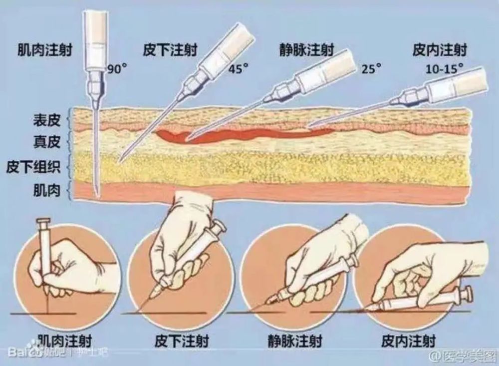 注射疫苗注射位置大多数都是在深层皮下或者是肌肉处.