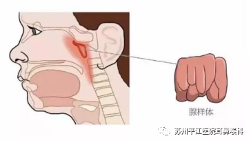 扁桃体和腺样体,到底要不要全切?