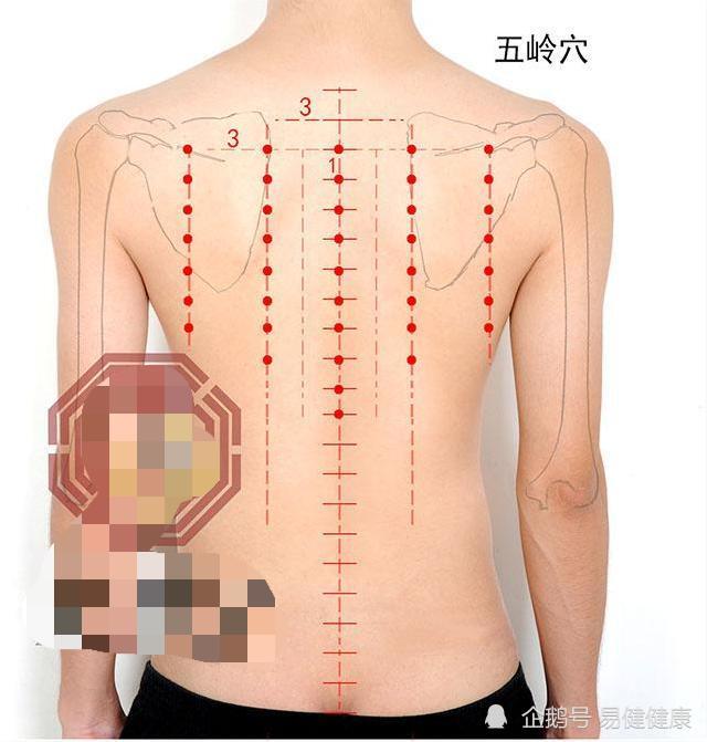 中医健康养生之人体背部穴位五岭穴