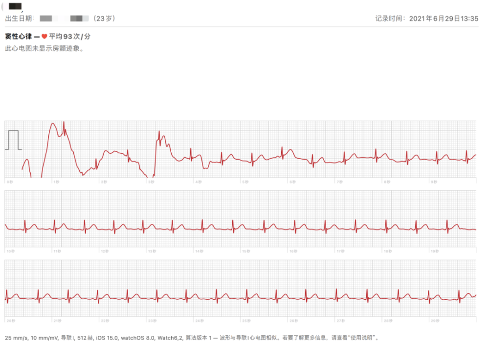 apple watch导出的心电图pdf ▲ 苹果健康应用中有"导出pdf给医生