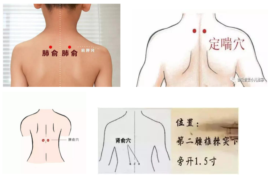 王林洋医生介绍了东直门医院呼吸科关于三伏贴敷所用的药物,基本是辛