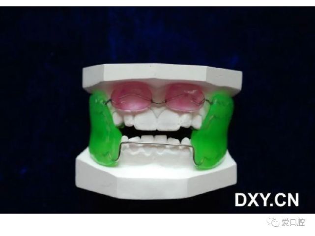 正畸活动矫治器图谱