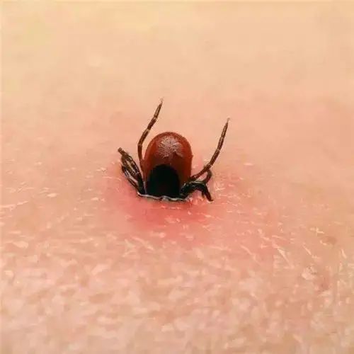 通常来说,被蜱虫咬了之后,轻微的症状就是被咬的部位,会出现发红或有