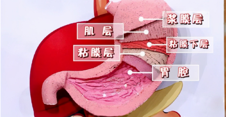 长期服用阿司匹林会损伤胃粘膜医生确实有可能