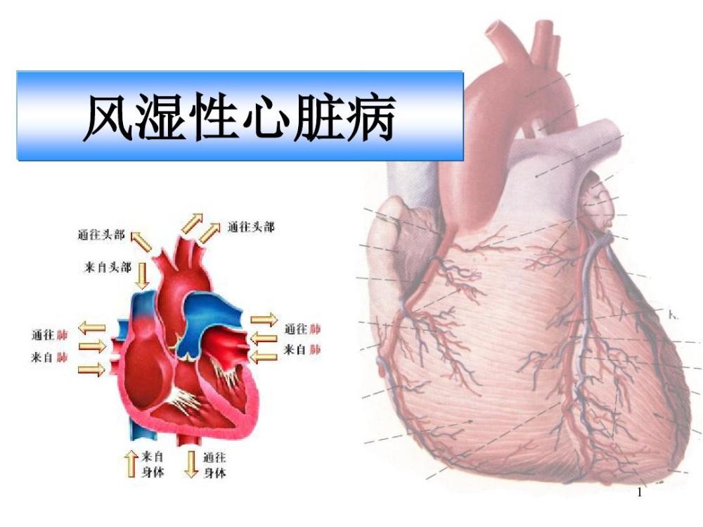 心脏病其实还有好多种?看完下文就明白