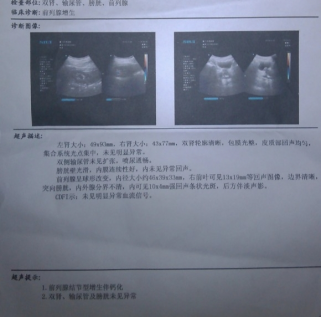 尿不出,尿流细,尿不尽,要警惕前列腺增生