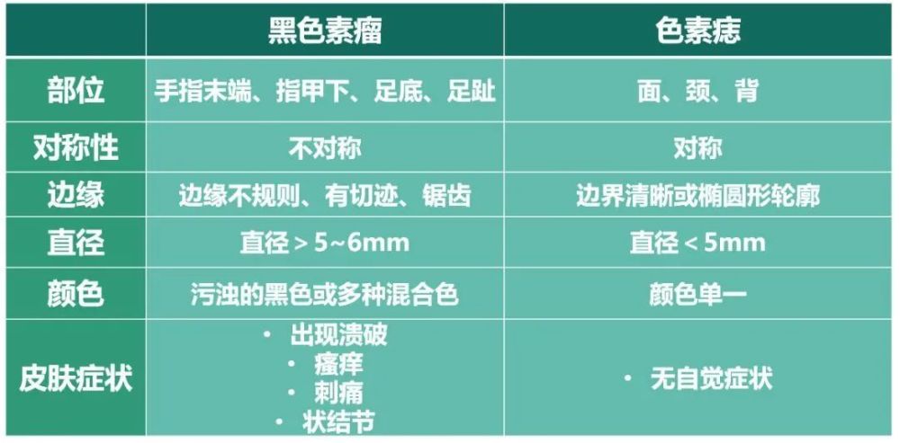 身上的痣出现5种症状需警惕是恶性黑色素瘤