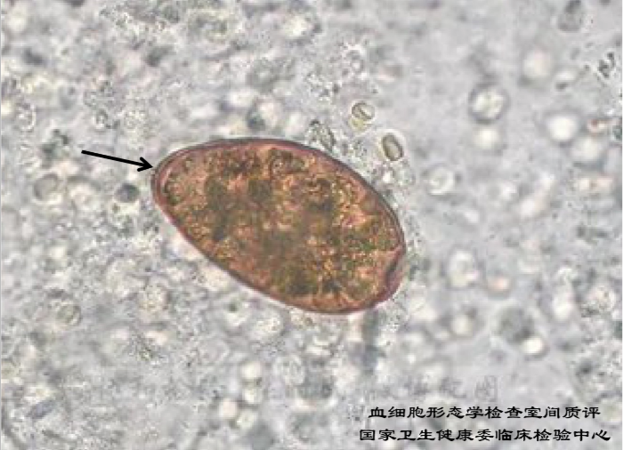 2020年寄生虫形态学检查室间质评及答案