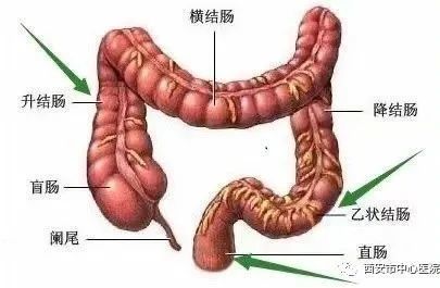 阑尾炎与盲肠炎还傻傻分不清楚吗一位盲肠炎患者自述