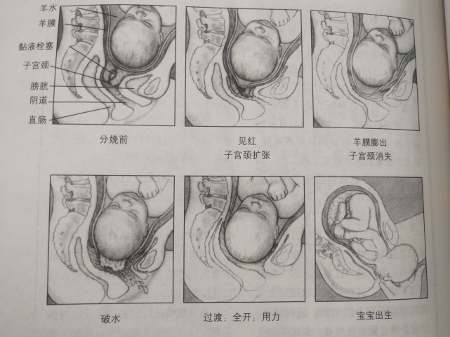 什么是宫缩,生孩子时宫缩是怎样一种疼法?看看过来人