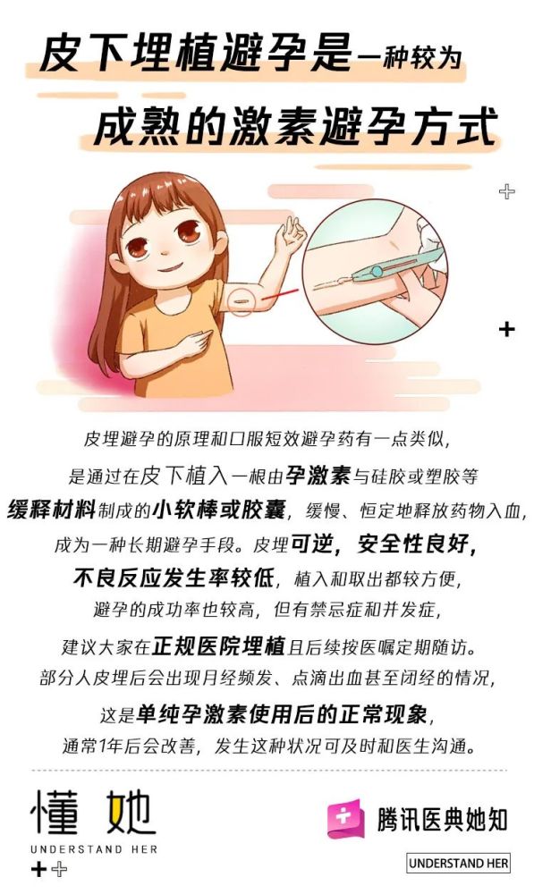 皮埋避孕真的那么好吗?会不会有危险?