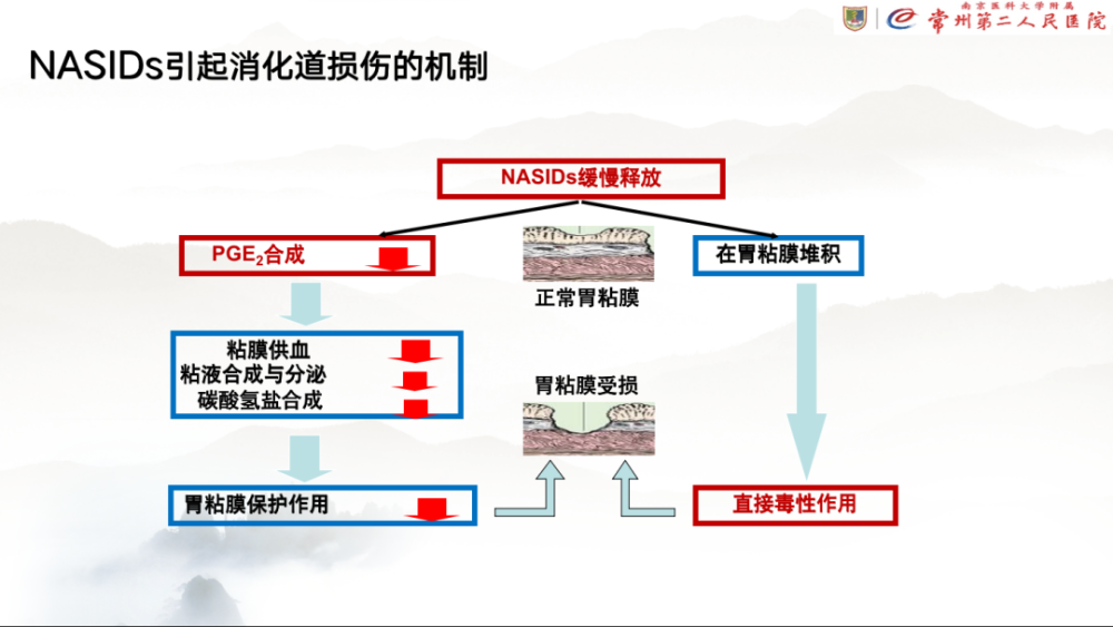 刘文佳教授:非甾体抗炎药引起的消化道出血治疗体会