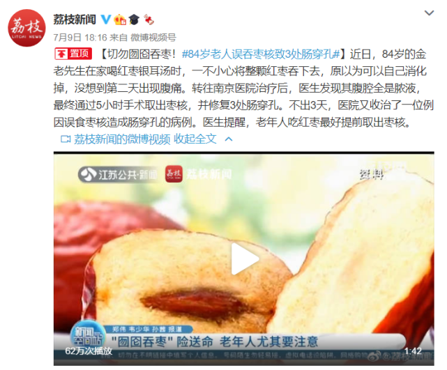 84岁老人误吞枣核致3处肠穿孔