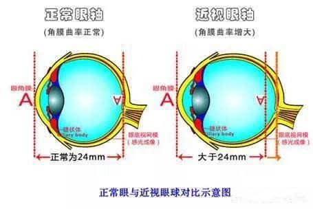 保护视力,拒绝近视!家长们看这里!