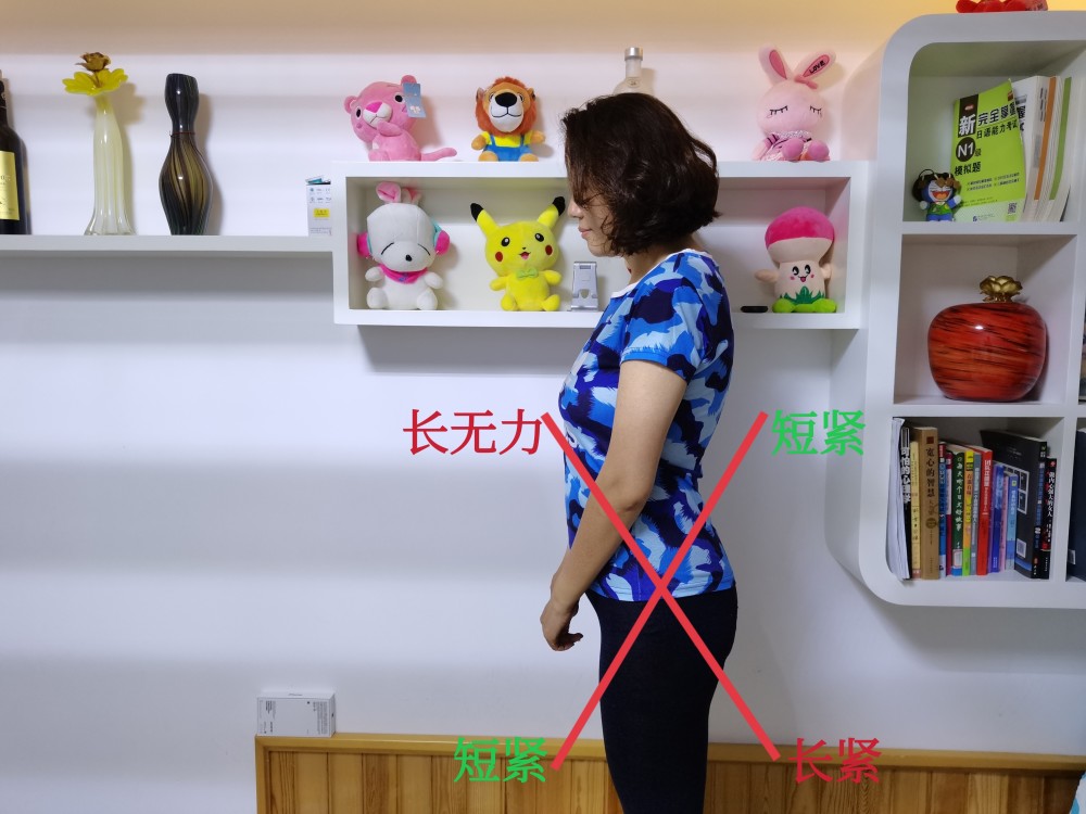 下交叉综合症有两种,你是哪一种?