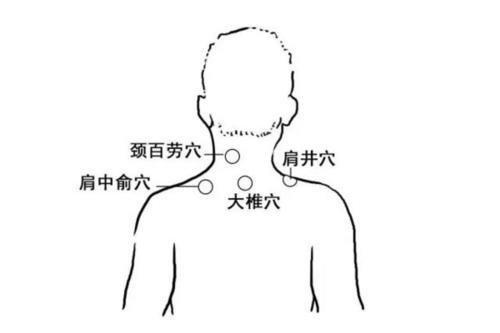 颈百劳穴可缓解视力问题