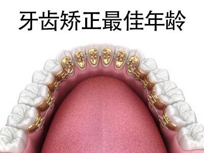 天津牙齿正畸有必要吗-矫正牙齿有年龄限制吗?