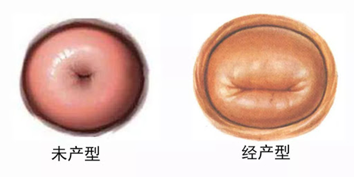 婚前做过人流术,要不要和医生坦白?