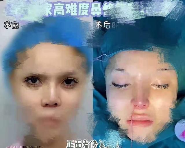 美女网红"大佬儿"性别引争议,多位网友爆料,整容前照片也流出