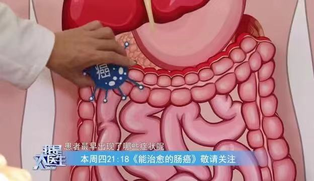 大便太粘是湿气太重还是肠癌警报好多人都没分清