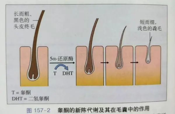 每天掉5060根头发是正常的超过多少是不正常呢