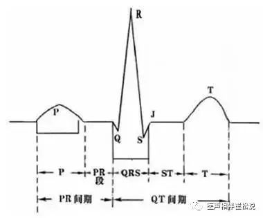 那些年我们过度解读的心律失常——i 度房室传导阻滞